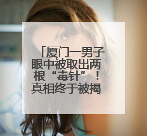厦门一男子眼中被取出两根“毒针”！真相终于被揭开